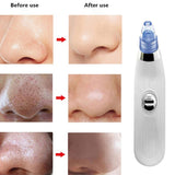 electric facial pore cleaner